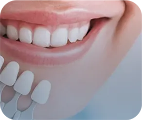 کامپوزیت دندان در کلینیک دندانپزشکی آرتمیس